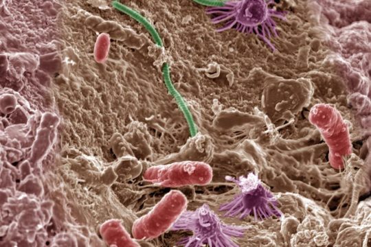 Microbial Power: Meet the Workers Regenerating Your Soil