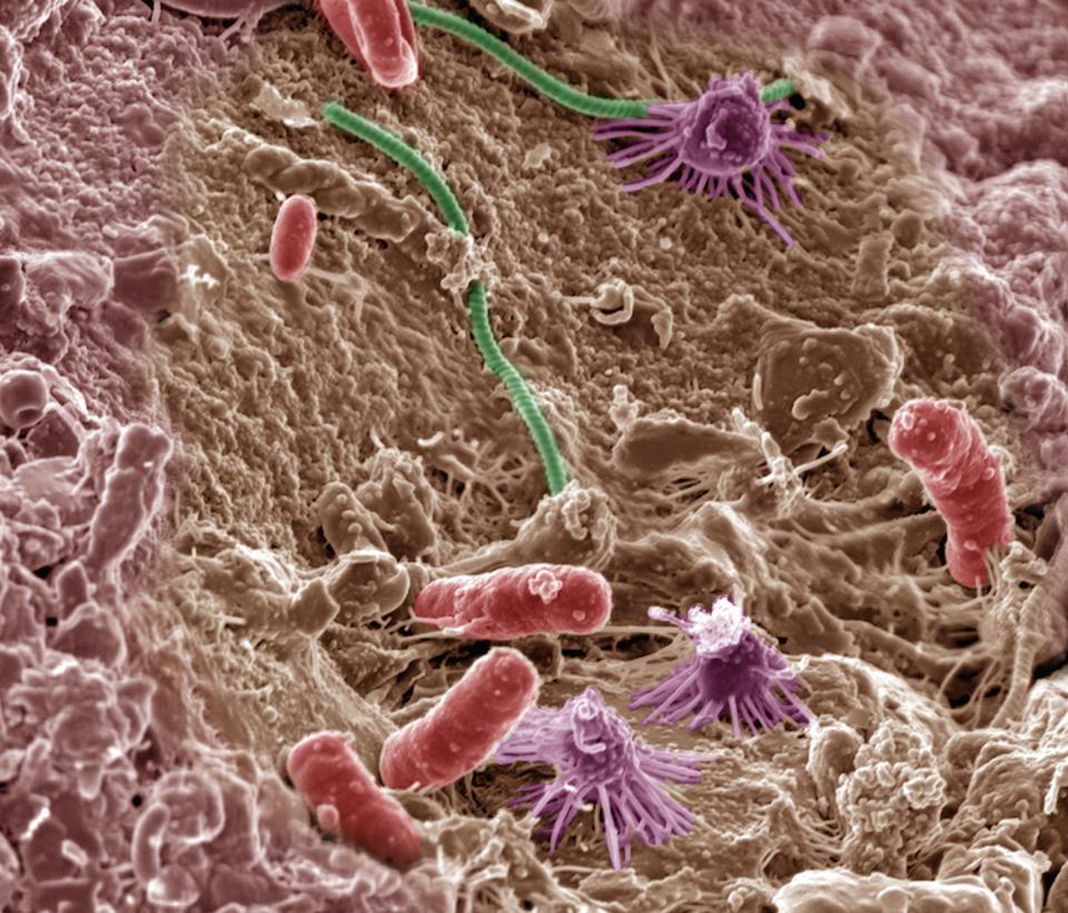 Microbial Power: Meet the Workers Regenerating Your Soil